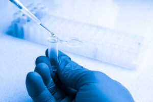 Clinical laboratory in process of chemical analysis. Collection of probe using automatic pipette