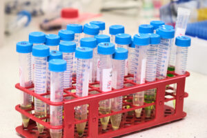 15 ml conical centrifuge tubes with blue screw caps arranged in a red rack on a laboratory bench