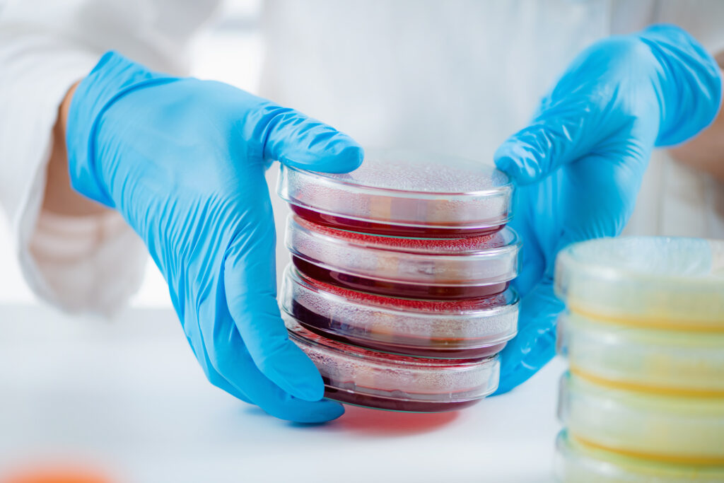 Condensation in petri dishes during routine laboratory incubation