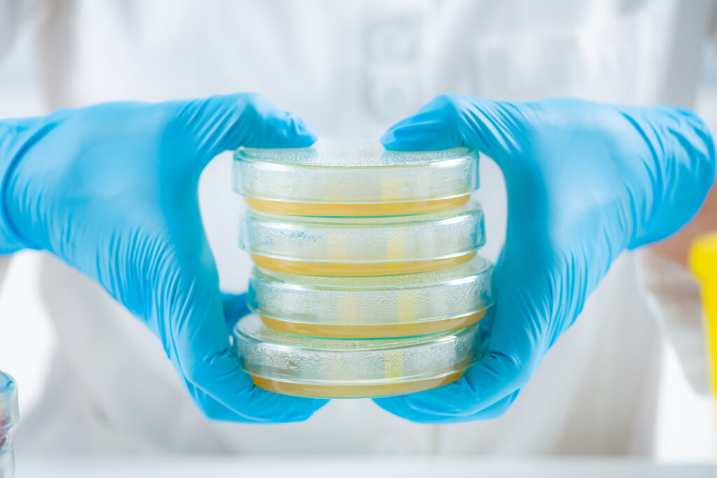 Hands handling stacked Petri dishes during routine laboratory work