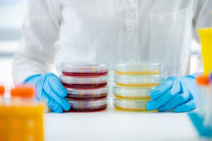 Petri dishes handled during routine laboratory work